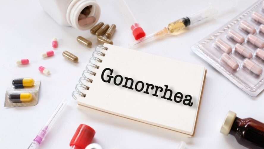 Gonorrhea the most common sexually transmitted infections