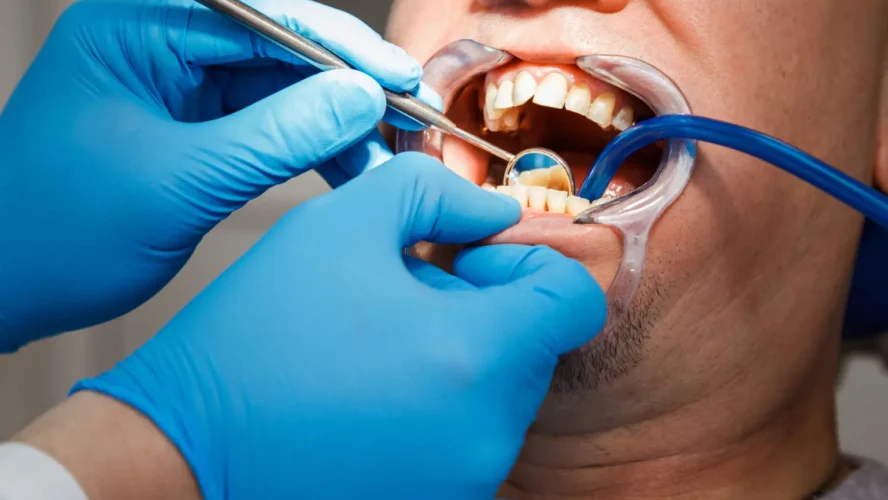 Addressing Common Dental Problems with Tooth-Colored Fillings