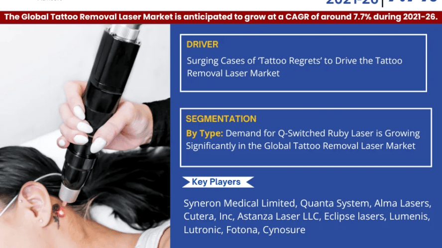 Forecast:  Tattoo Removal Laser Market to Grow at 7.7% CAGR Over the Next Five Years