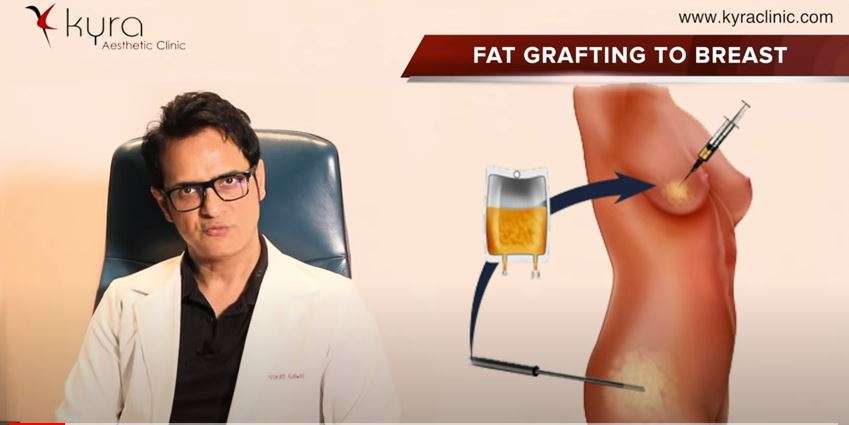 Fat Transfer to Breast in Ludhiana