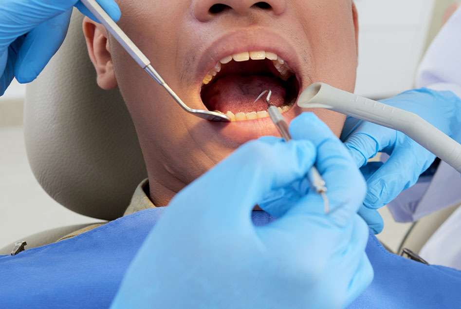 Why Choose Root Canal Treatment in Mernda?