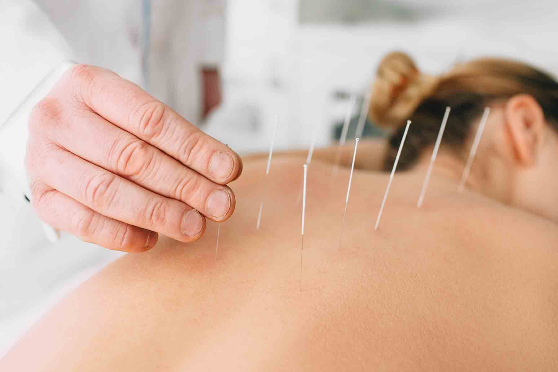 What are the benefits of nearby acupuncture clinics?