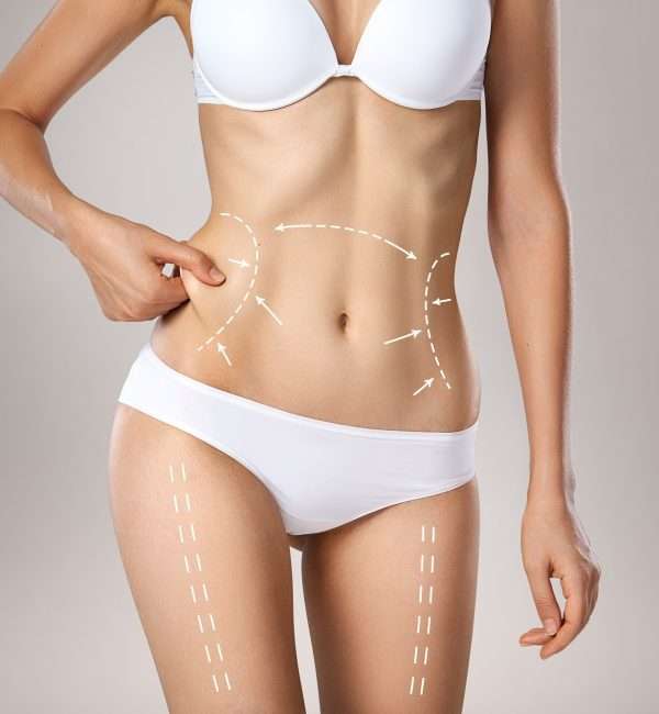 How to Maintain Open Communication with Your Best Tummy Tuck Surgeon During Recovery in Dubai