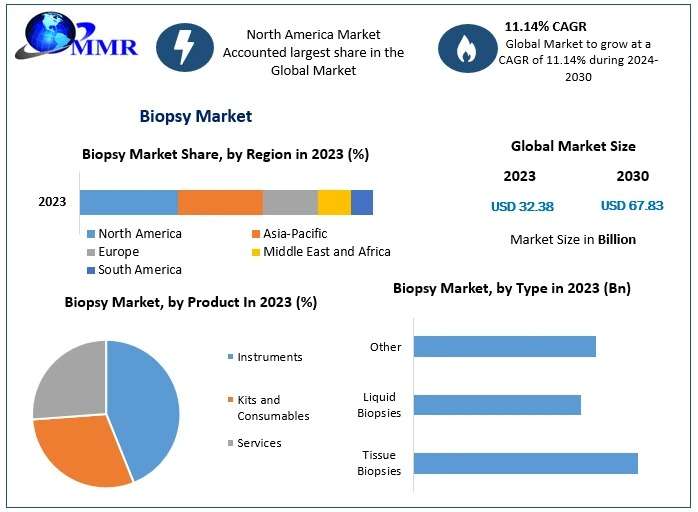 Biopsy Market Analysis by Trends, Size, Share, Growth Opportunities And Forecast 2030