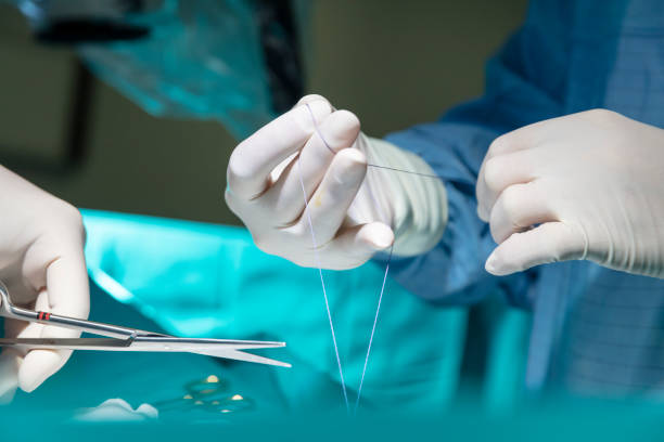 Automated Suturing Devices Market to Exhibit a Remarkable considerable CAGR by 2030, Size and Competitive Outlook