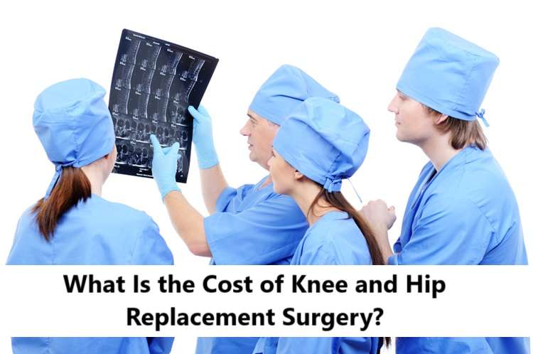 What Is the Cost of Knee and Hip Replacement Surgery