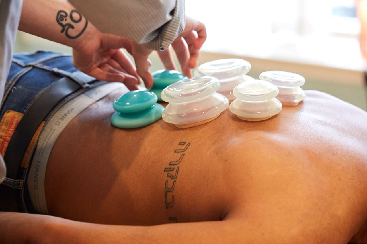 Cupping Therapy Philadelphia: A Guide to Healing Benefits