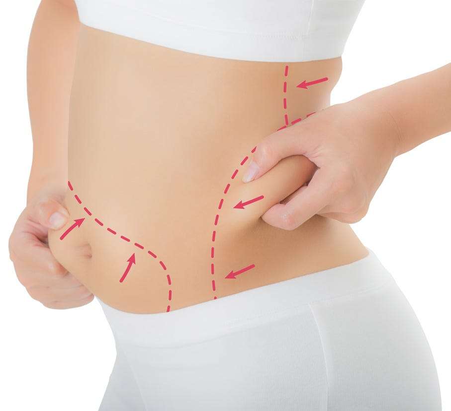 Preparing Your Home for a Smooth Recovery After Liposuction in Dubai