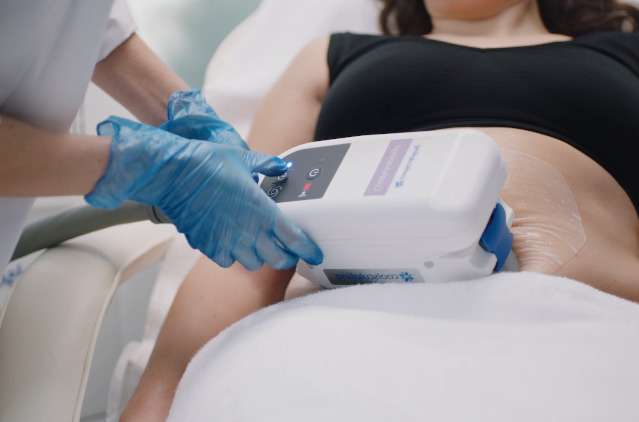 What is CoolSculpting?