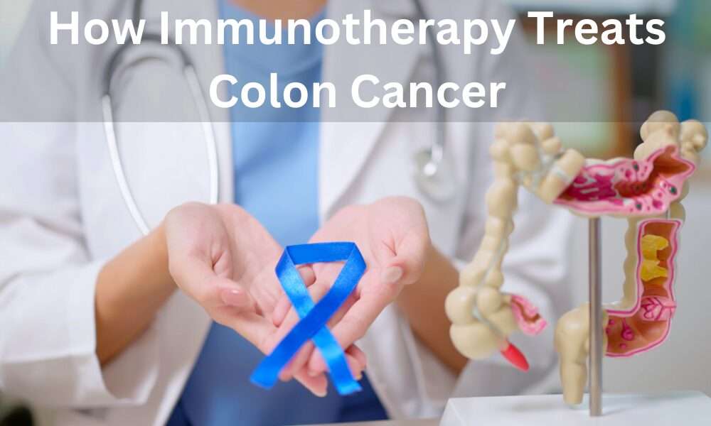 How Immunotherapy Treats Colon Cancer