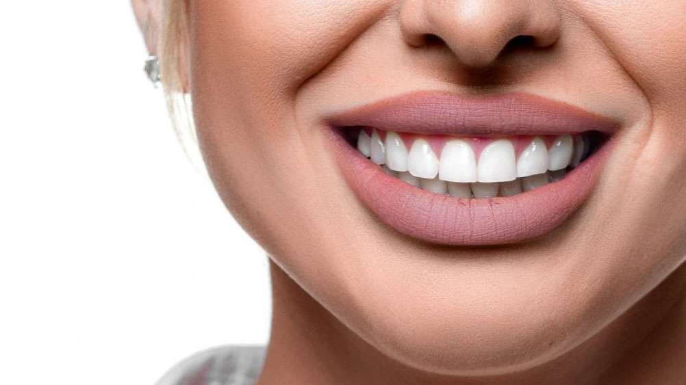 Unlocking Your Dream Smile at Hollywood Smile Dental Clinic